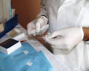 Fine needle aspiration biopsy preparation